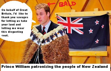 prince william hair transplant. Prince William, in New Zealand