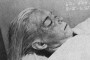 Marilyn Monroe Autopsy -- how does she look now?