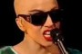 Lady Gaga Suffering From Rare Balding Disease.  Alopecia Totalis. 