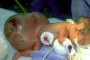 Facebook Photo of Newborn With Giant Tumor -- CLICK FOR DOLLARS - HOAX & FAKE