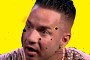 Mike The Situation's Face Mole Getting Worse From Stress.  