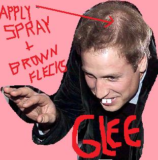 Joey Lawrence and Prince William to appear on GLEE to talk about spray-on hair.