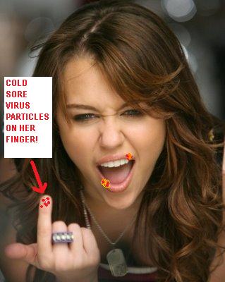 Miley Cyrus Gong — coated with herpes virus?
