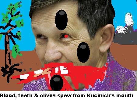 Kucinich: Olive lawsuit is serious.