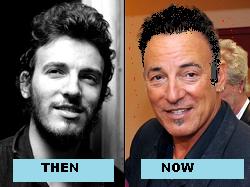 Bruce Springsteen – Plastic Surgery?  Hair Transplants?