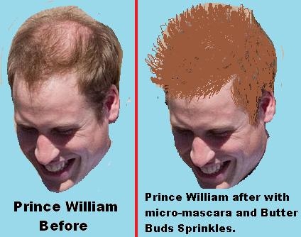 Prince William’s Balding Hair Fixed For Wedding Day!