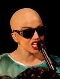 Lady Gaga Suffering From Rare Balding Disease.  Alopecia Totalis.