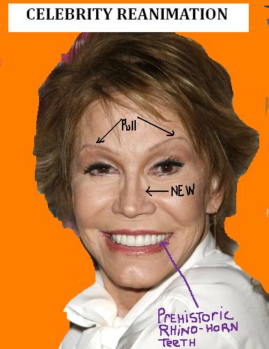 The New Mary Tyler Moore.  More Than Just Plastic Surgery.
