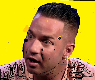 Mike The Situation’s Face Mole Getting Worse From Stress.