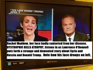 maddow face