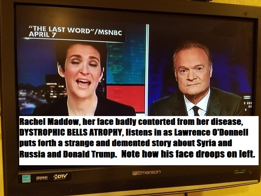 MSNBC LAWRENCE O’DONNELL DEMENTIA